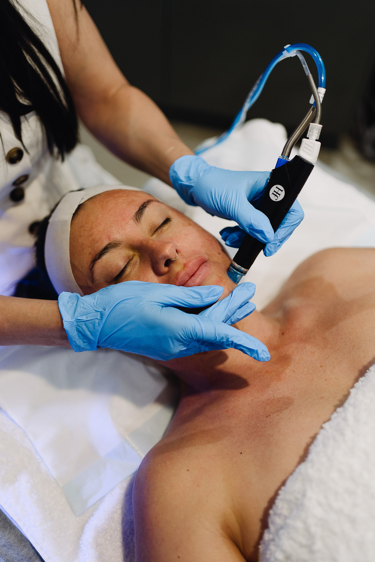 Professional Hydrafacial treatment procedure